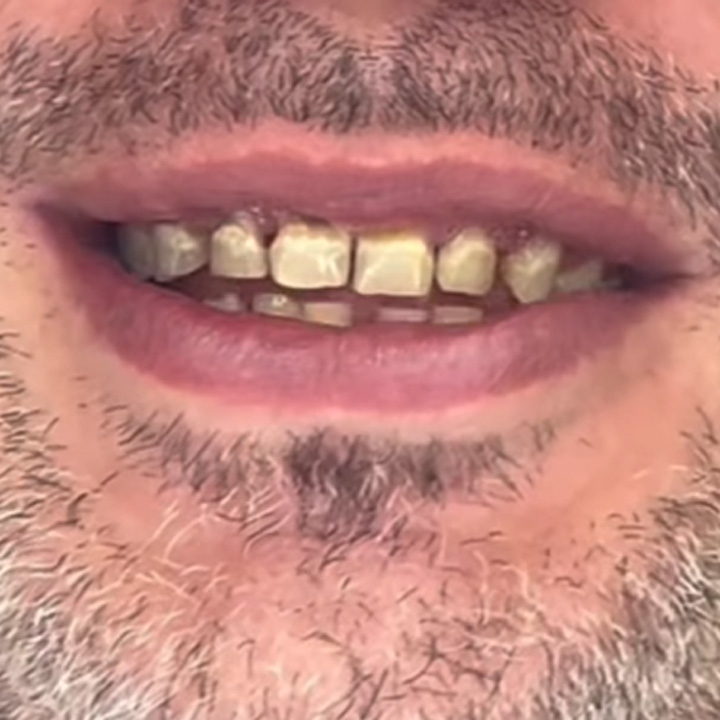 Pas